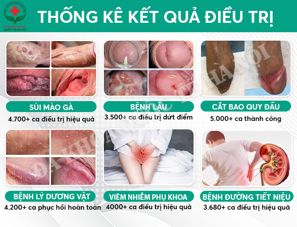 kết quả điều trị