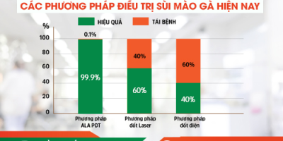 phuong-phap-ho-tro-dieu-tri-sui-mao-ga-hieu-qua-hien-nay-chuyen-gia-dau-nganh-chia-se