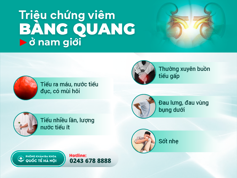 viêm bàng quang