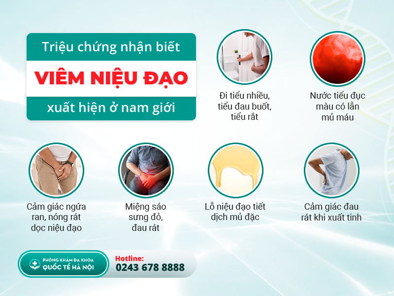 viêm niệu đạo nam