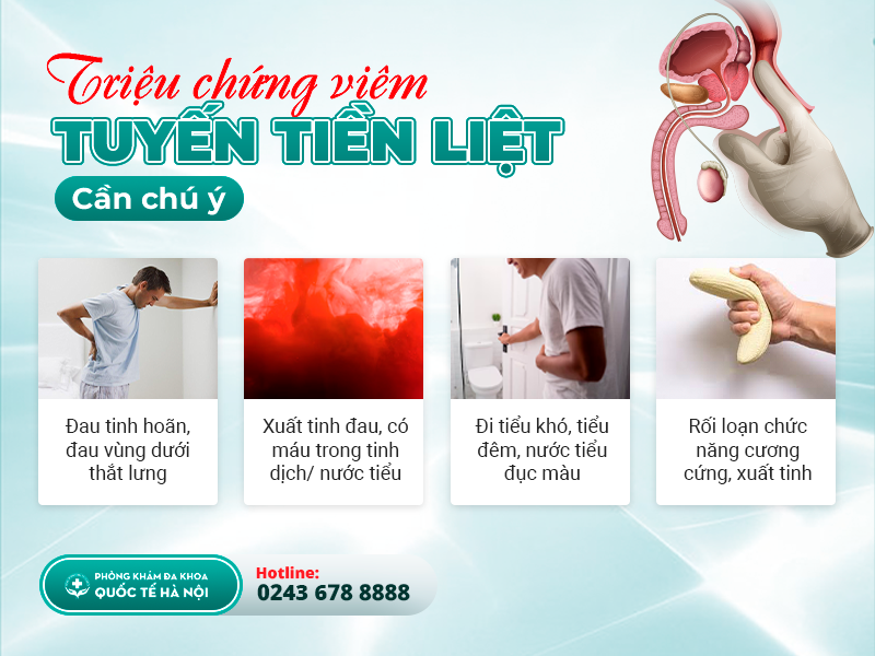 viêm tuyến tiền liệt