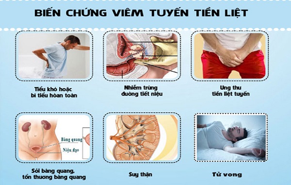 biến chứng viêm tuyến tiền liệt