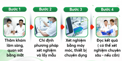 bat-mi-dia-chi-xet-nghiem-cac-benh-tinh-duc-chinh-xac-kin-dao-tai-ha-noi