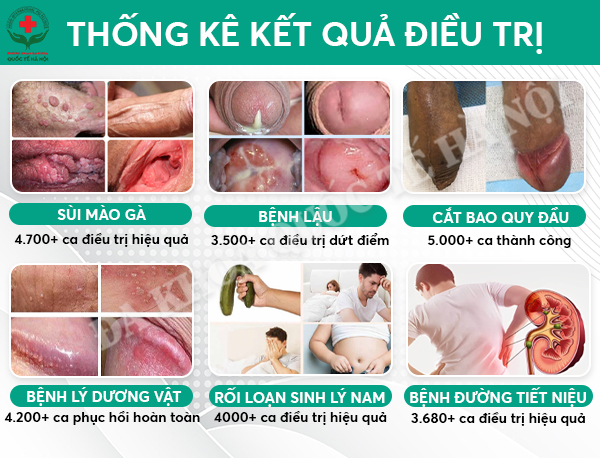 thống kế kết quả điều trị tại đa khoa quốc tế 152 xã đàn