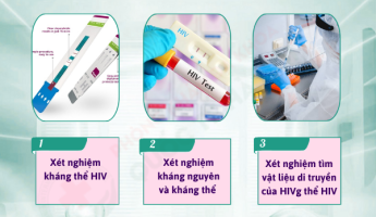 xet-nghiem-hiv