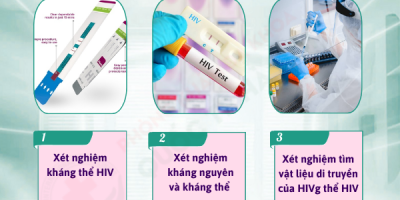 xet-nghiem-hiv