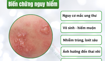 mun-rop-sinh-duc-co-ngua-khong-bac-si-canh-bao-dau-hieu-de-bi-nham-lan