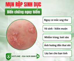 cach-chua-mun-rop-sinh-duc-nu-tai-nha-khi-meo-nho-tro-thanh-con-dao-hai-luoi