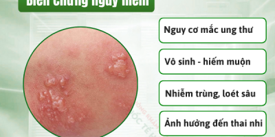 cach-chua-mun-rop-sinh-duc-nu-tai-nha-khi-meo-nho-tro-thanh-con-dao-hai-luoi