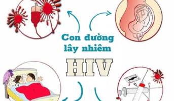 hiv-la-gi