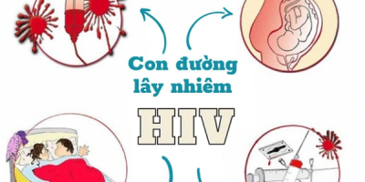 hiv-la-gi