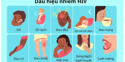 trieu-chung-hiv