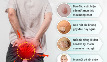 ai-noi-sui-mao-ga-hau-mon-khong-nguy-hiem-ung-thu-hau-mon-hoan-toan-co-the-xay-ra-neu-chu-quan