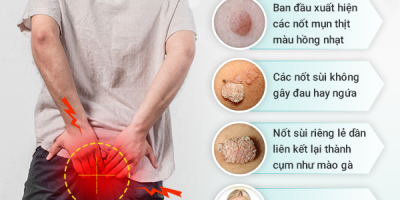 ai-noi-sui-mao-ga-hau-mon-khong-nguy-hiem-ung-thu-hau-mon-hoan-toan-co-the-xay-ra-neu-chu-quan