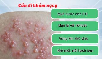 mun-rop-sinh-duc-o-nam-qua-tung-giai-doan-xem-de-nhan-biet-som