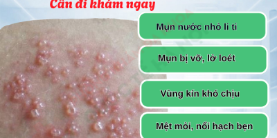 mun-rop-sinh-duc-o-nam-qua-tung-giai-doan-xem-de-nhan-biet-som