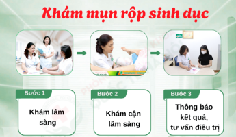 dung-doan-mo-soi-ky-hinh-anh-mun-rop-sinh-duc-nam-nu-kiem-tra-xem-ban-co-mac