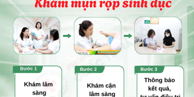 dung-doan-mo-soi-ky-hinh-anh-mun-rop-sinh-duc-nam-nu-kiem-tra-xem-ban-co-mac