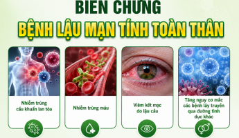 tieu-buot-tieu-ra-mu