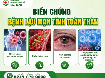 tieu-buot-tieu-ra-mu
