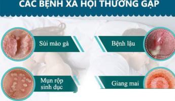benh-hoa-lieu-la-benh-gi-nguyen-nhan-va-cach-chua-hieu-qua