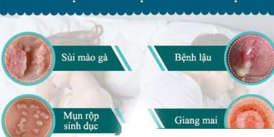 benh-hoa-lieu-la-benh-gi-nguyen-nhan-va-cach-chua-hieu-qua