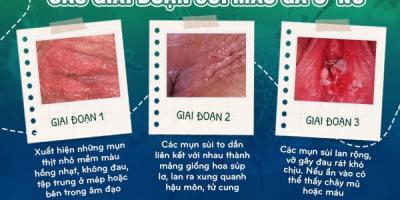 canh-bao-bi-loi-cuc-thit-o-cua-minh-co-the-la-dau-hieu-benh-nguy-hiem